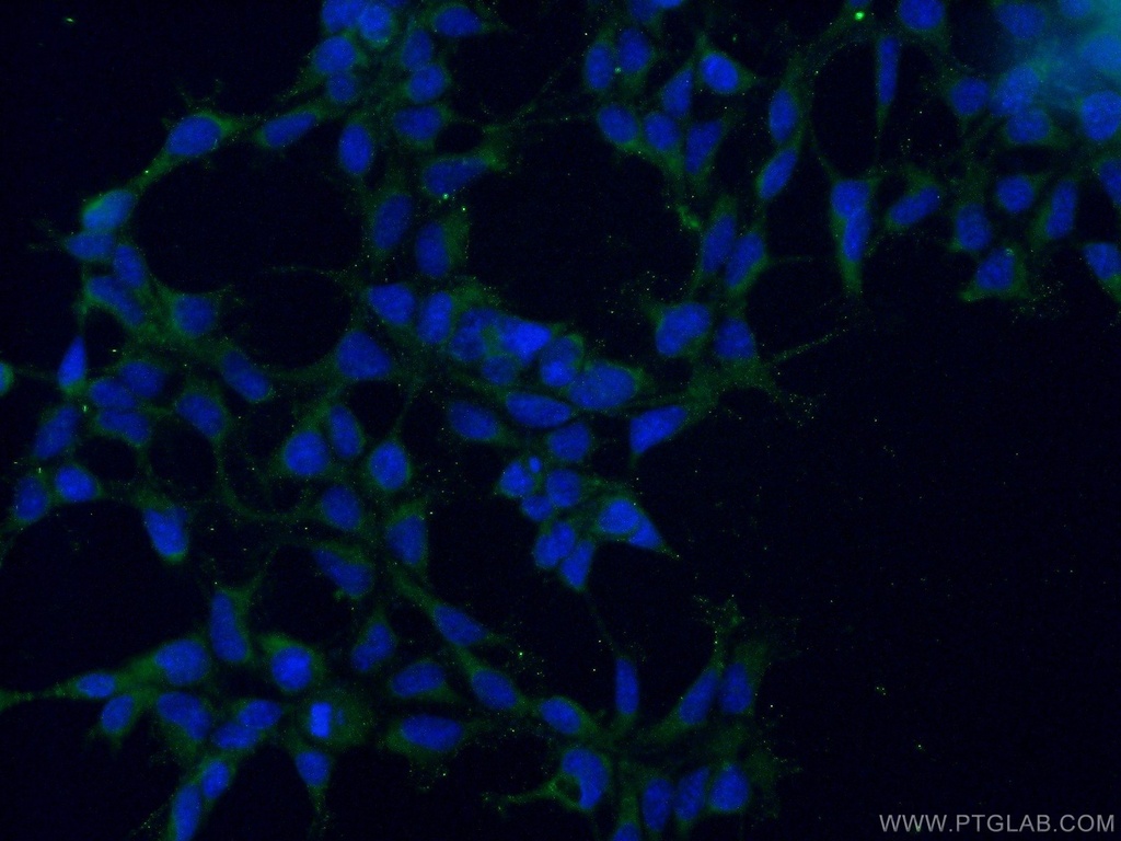 ALS2 Polyclonal antibody