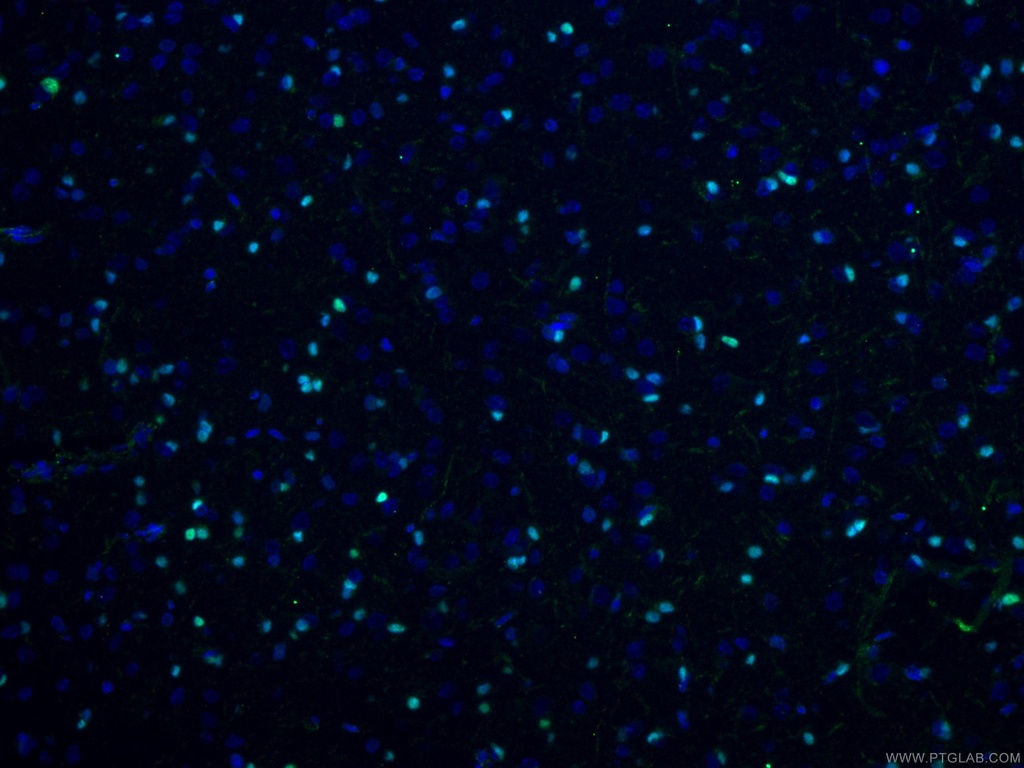 OLIG2 Polyclonal antibody