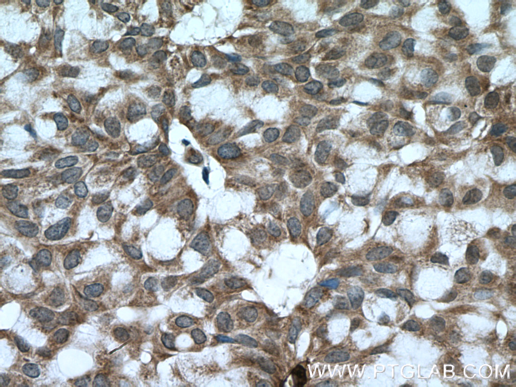BACH1 Polyclonal antibody