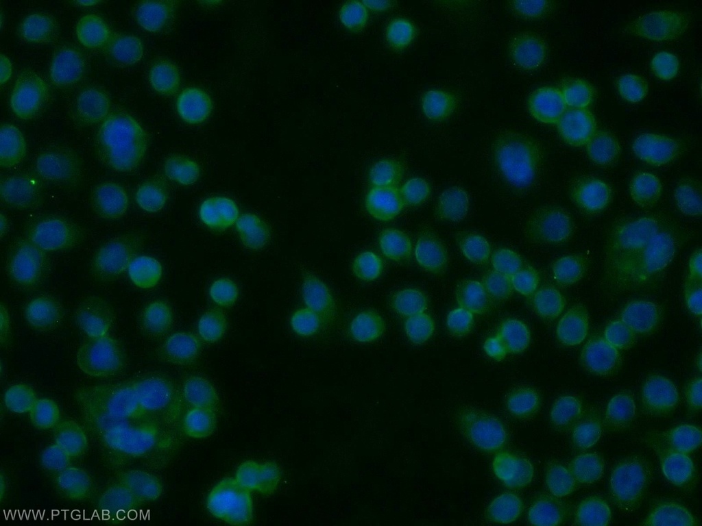 AADACL1 Polyclonal antibody