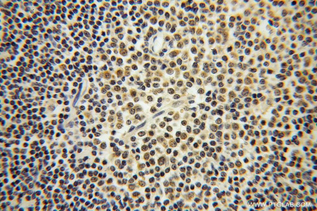 ROD1 Polyclonal antibody