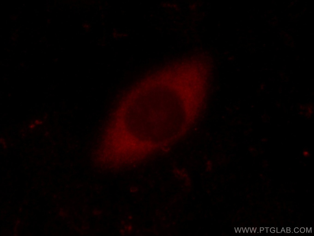 FEM1C Polyclonal antibody