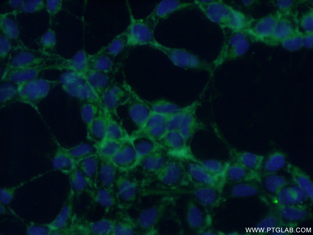 ABHD2 Polyclonal antibody