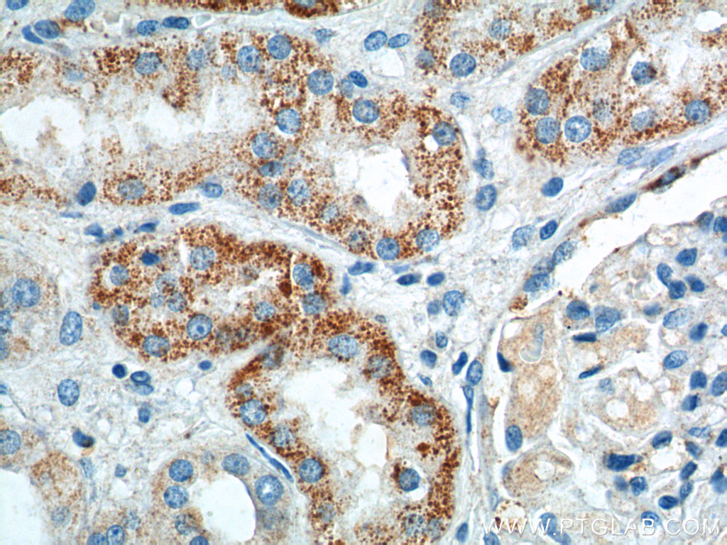 GPR116 Polyclonal antibody