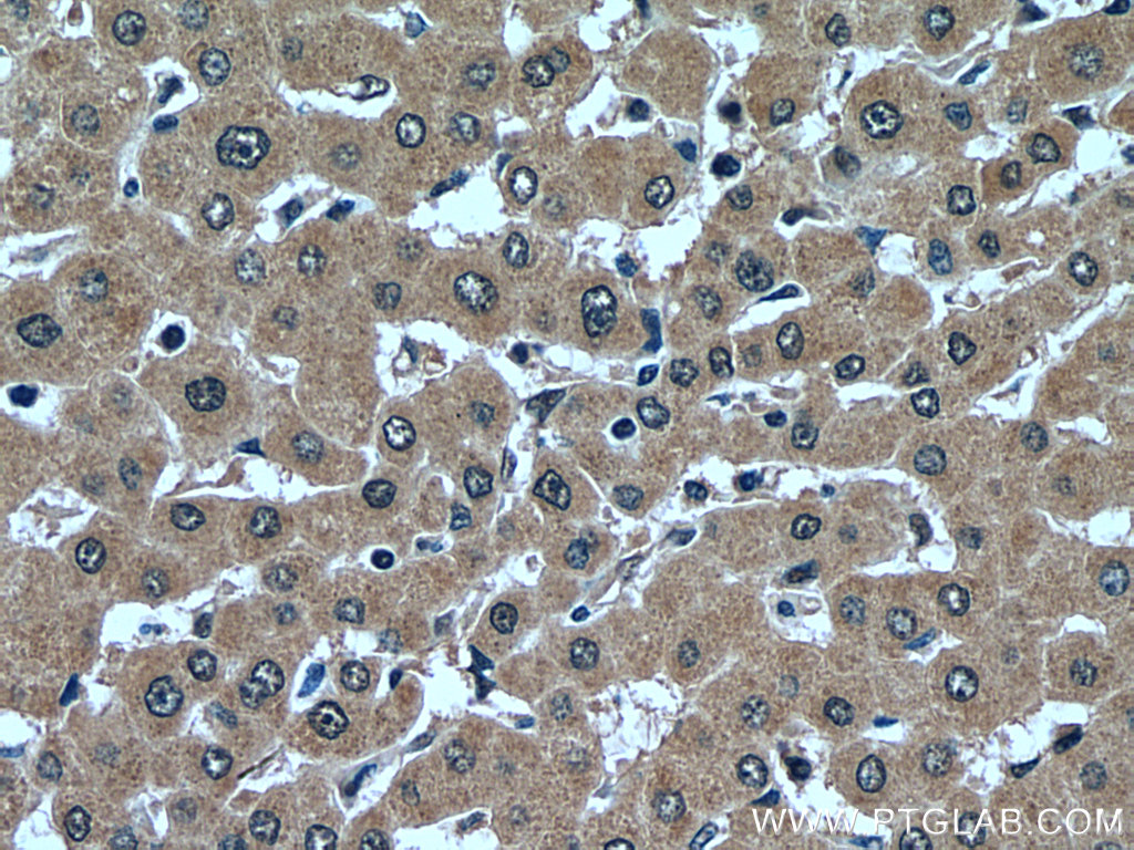 USP16 Polyclonal antibody