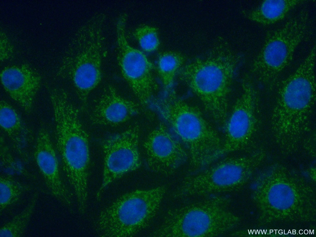 PARK2/Parkin Polyclonal antibody