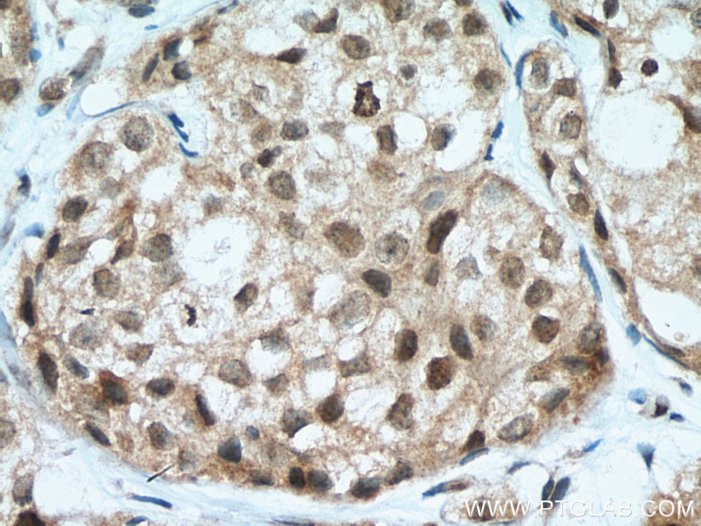 SETD8 Polyclonal antibody