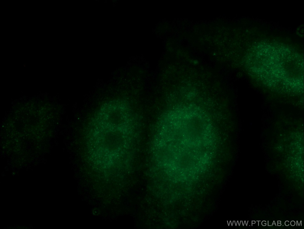 p38 MAPK Polyclonal antibody