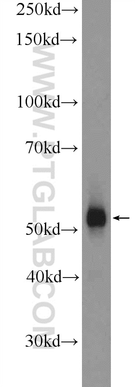 DAZ4 Polyclonal antibody