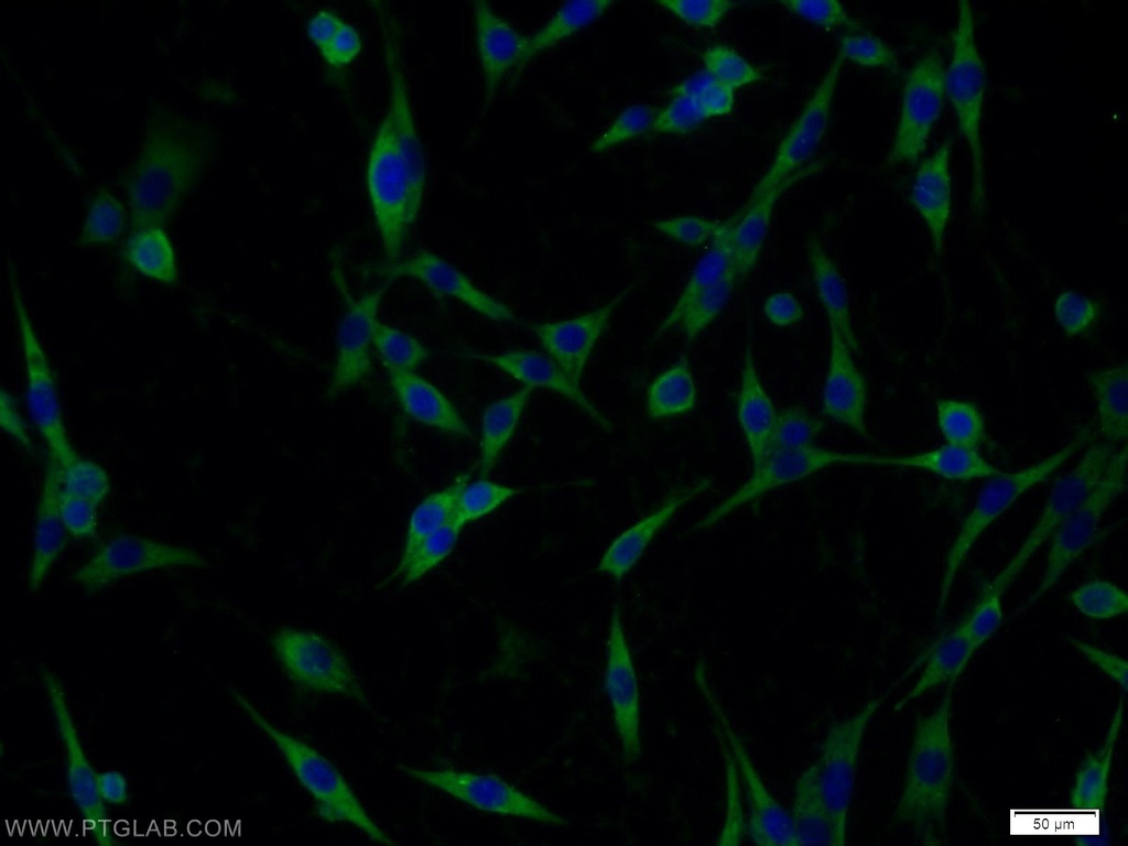 Nicastrin Polyclonal antibody