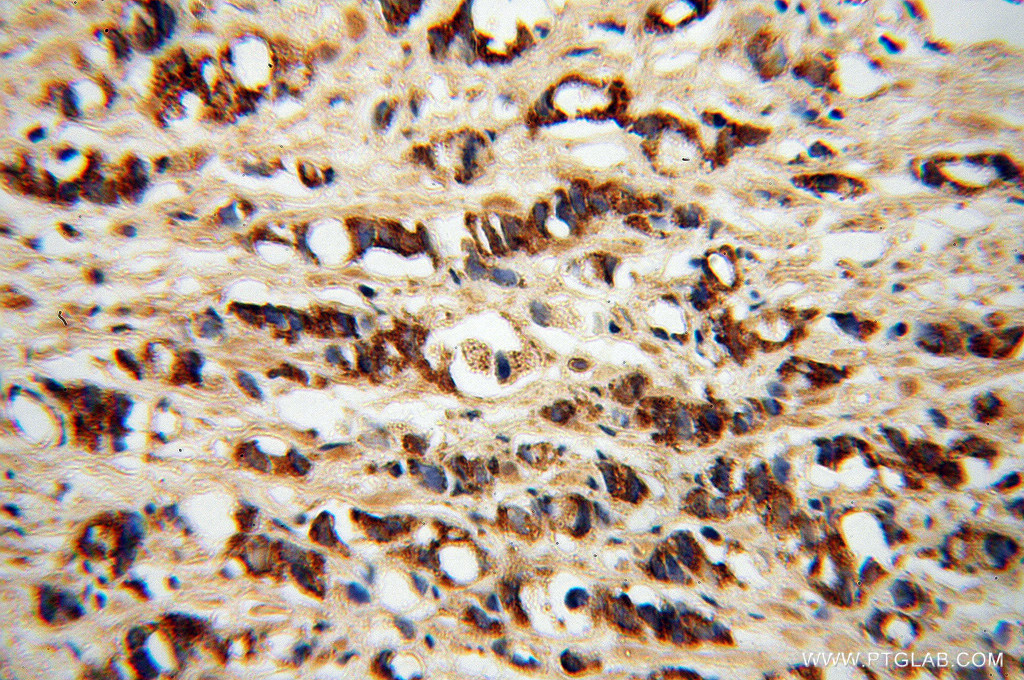PDGFD Polyclonal antibody