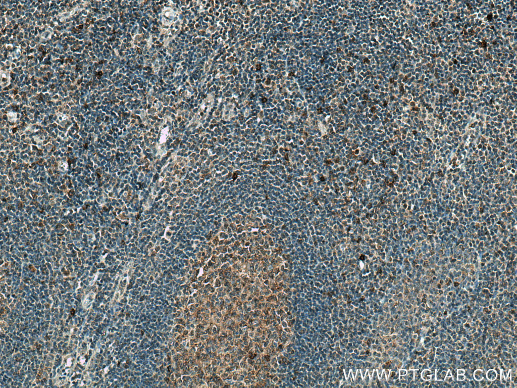 NINJ2 Polyclonal antibody