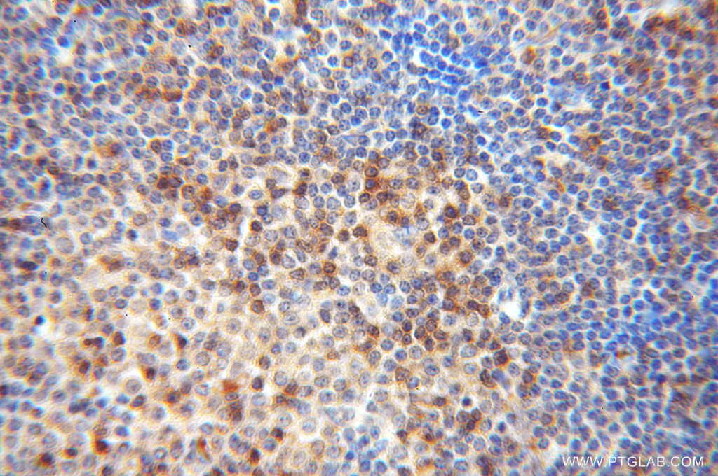 DOK2 Polyclonal antibody