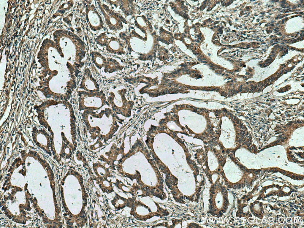 SLC5A11 Polyclonal antibody