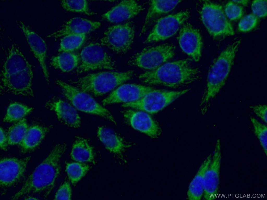 ARHGEF7 Polyclonal antibody