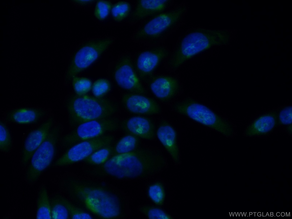 ACBD3 Polyclonal antibody