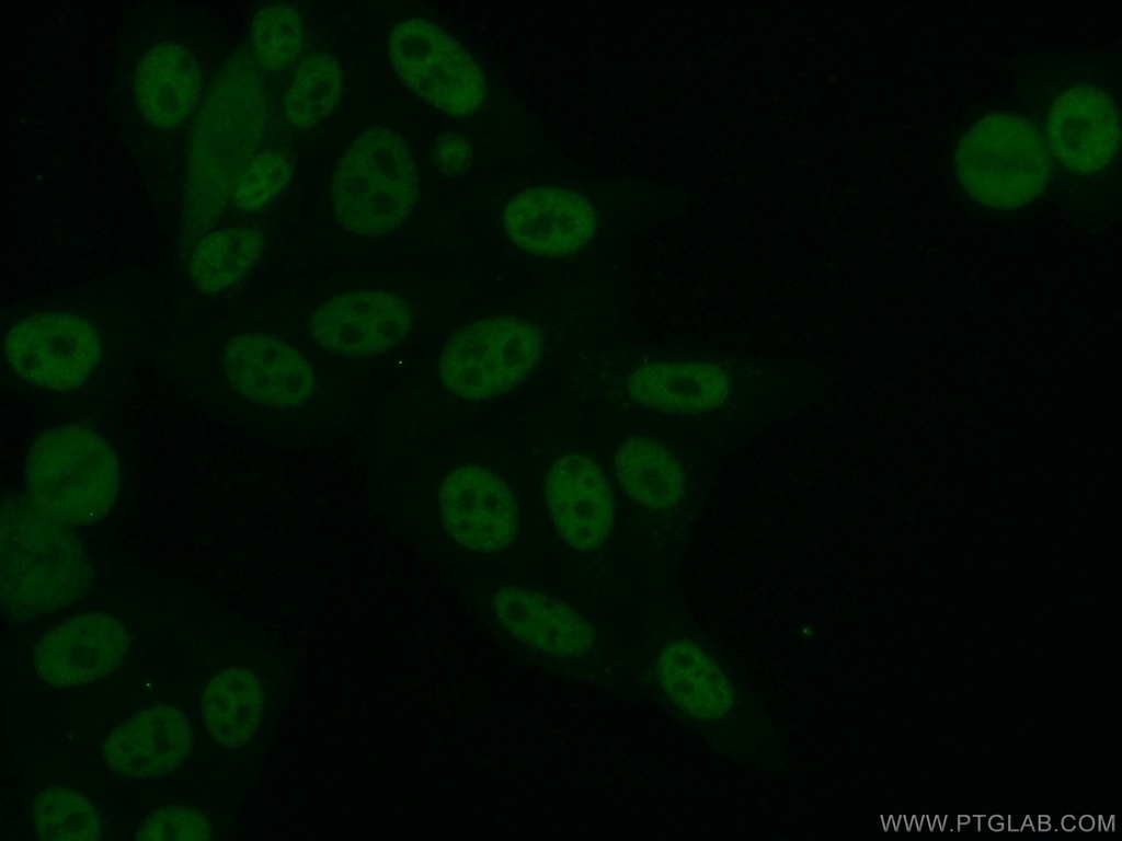 ARNT,HIF1B Polyclonal antibody