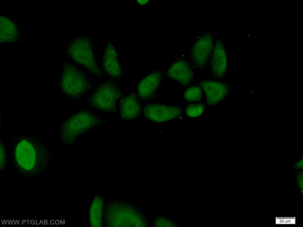 RNF8 Polyclonal antibody