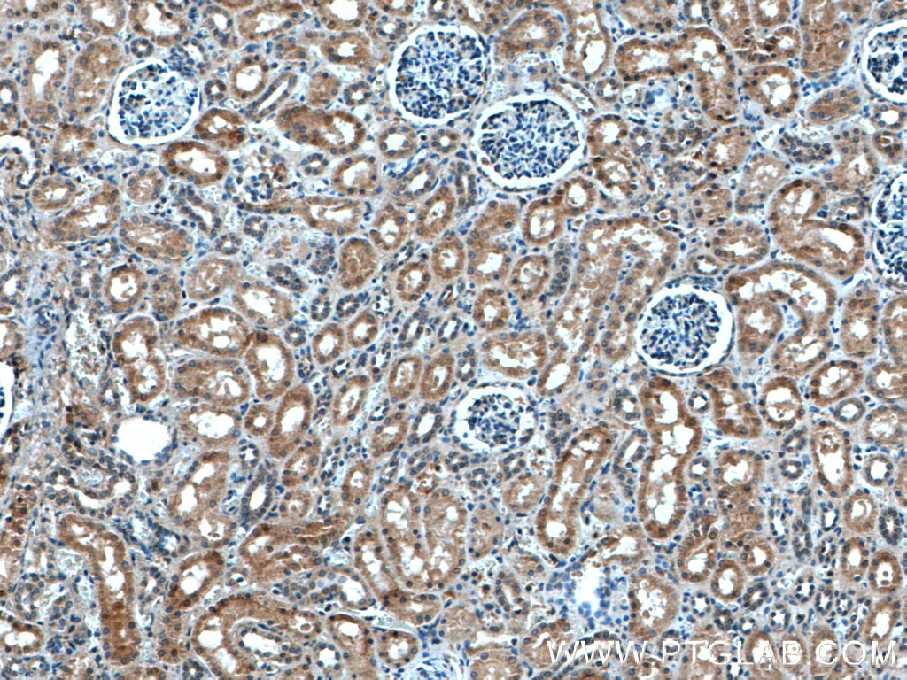 ASPH Polyclonal antibody