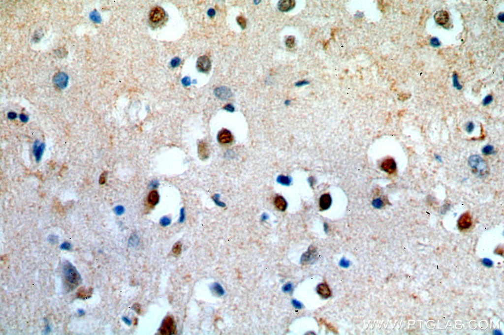 APC4 Polyclonal antibody
