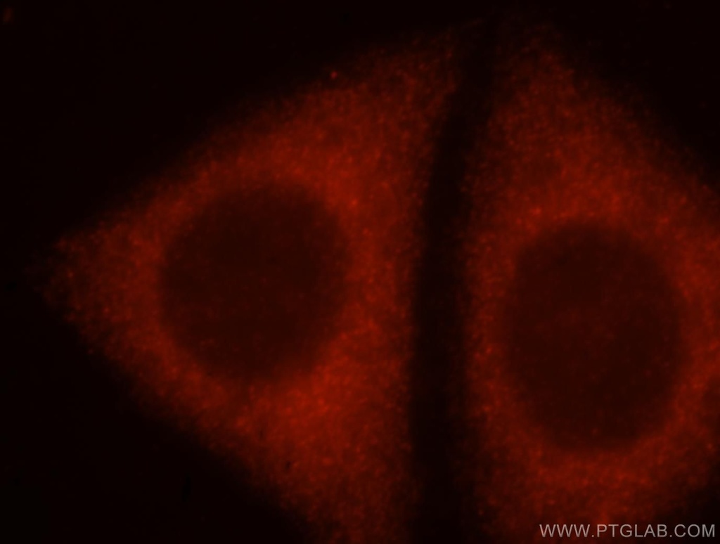 ADAM12 Polyclonal antibody