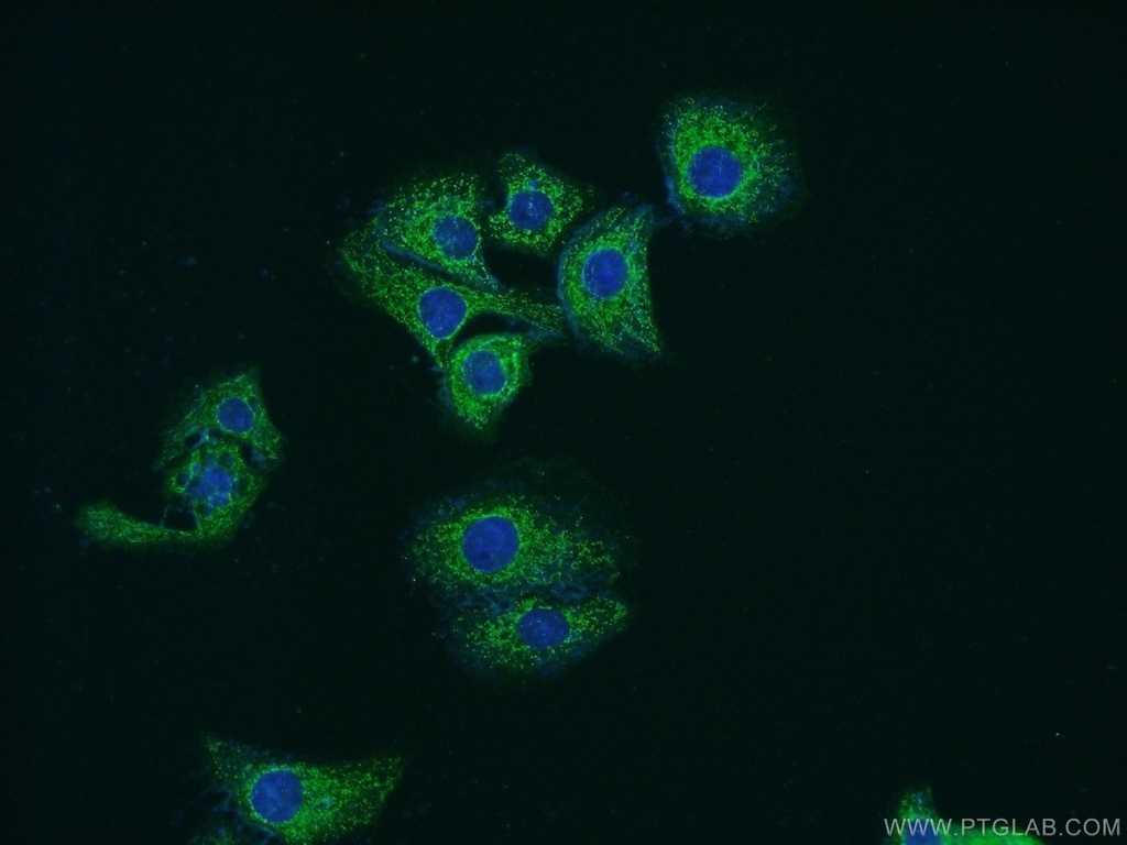 SLC25A45 Polyclonal antibody