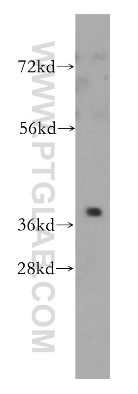 PTGR2 Polyclonal antibody
