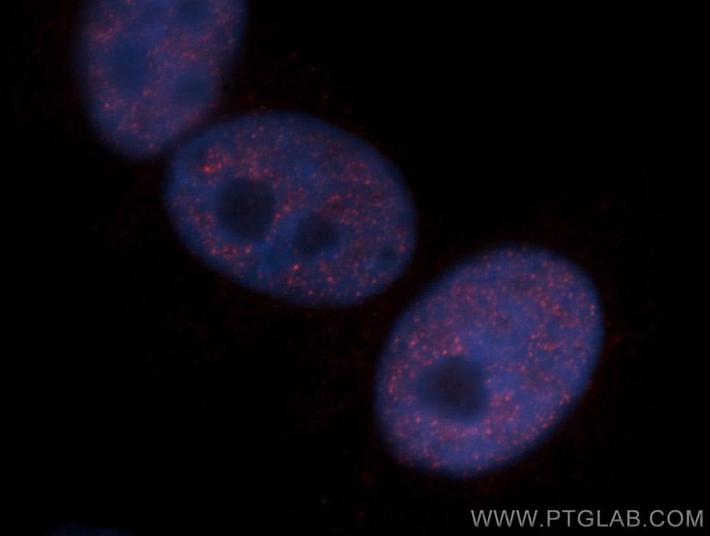 CHD4 Polyclonal antibody