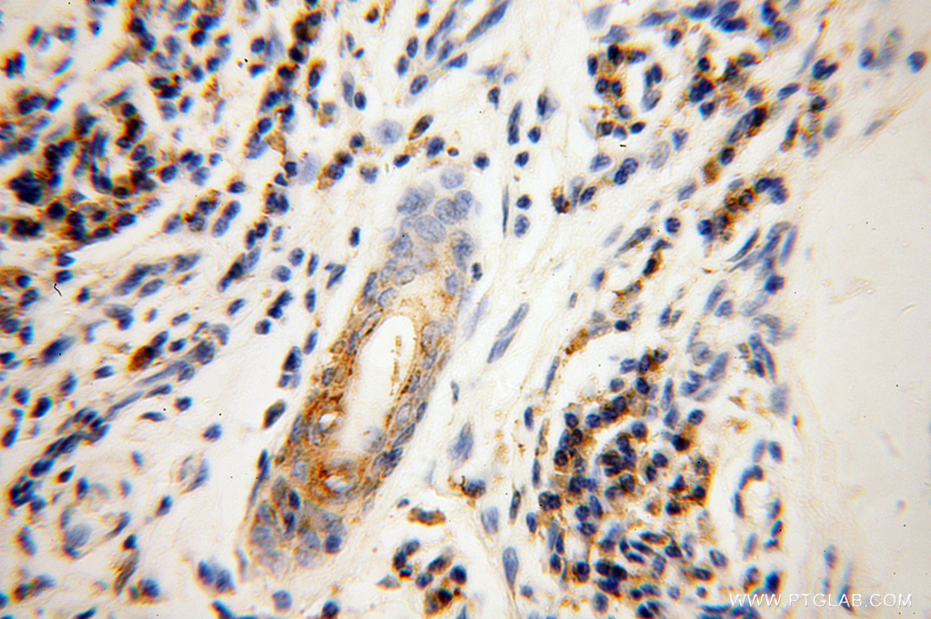 GK3P Polyclonal antibody