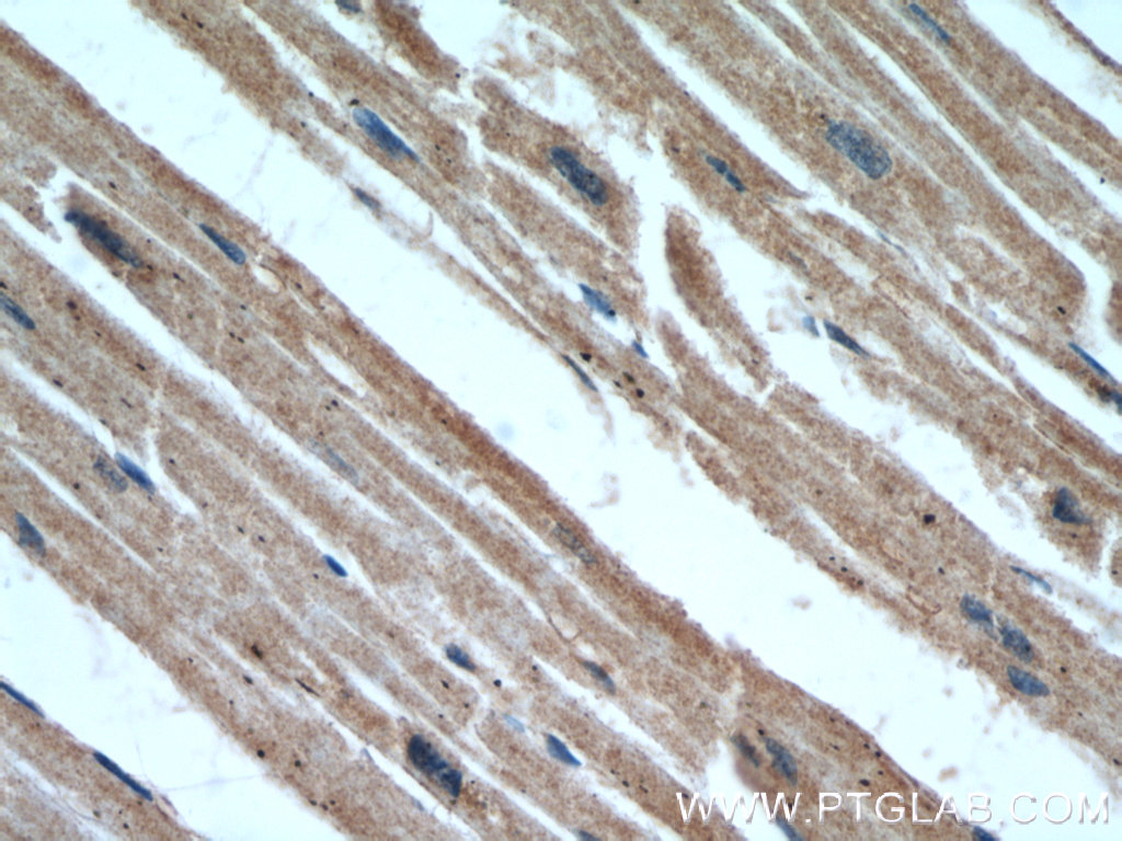 B3GALT2 Polyclonal antibody