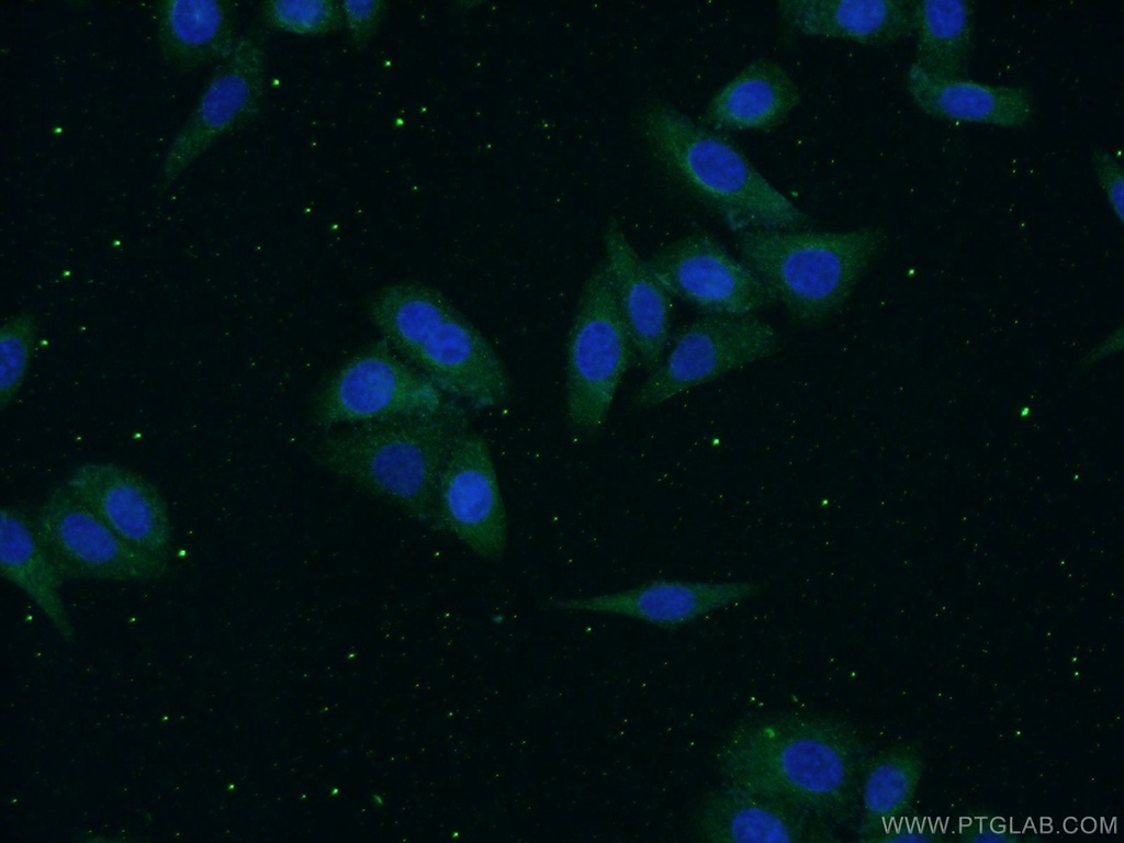 Alpha 1B-Glycoprotein Polyclonal antibody