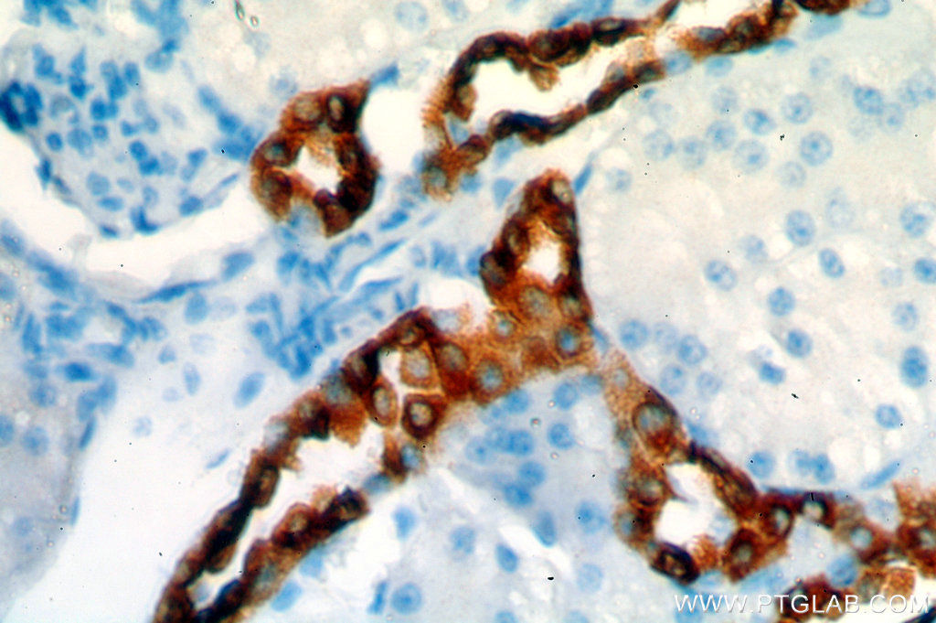 HSD11B2 Polyclonal antibody