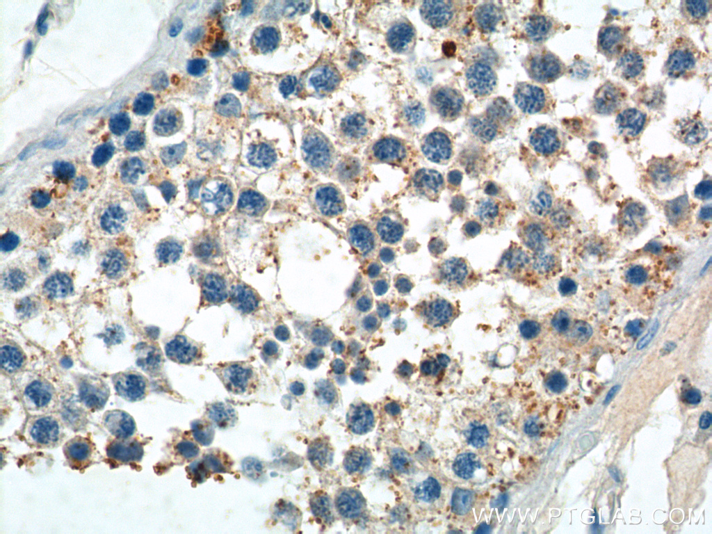 PIWIL2 Polyclonal antibody