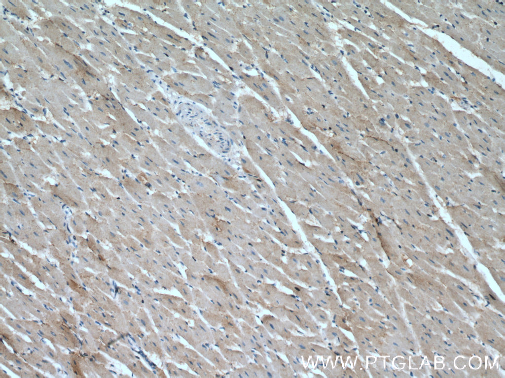 CCL14 Polyclonal antibody