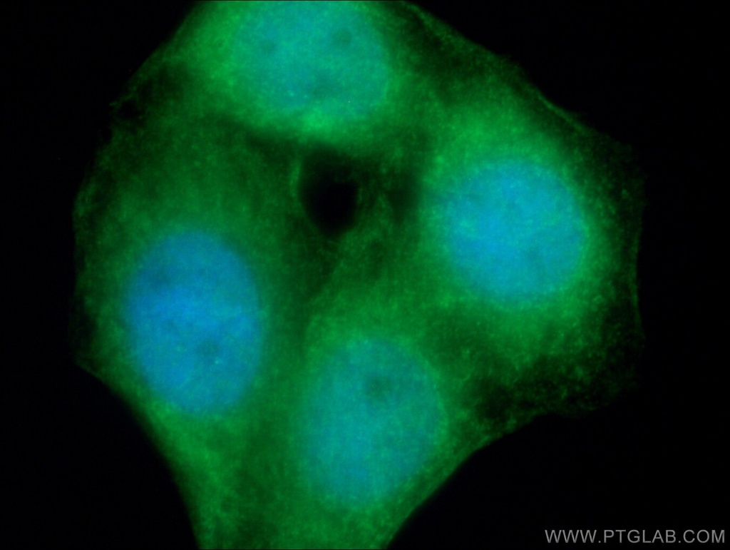 NFKB1 Polyclonal antibody