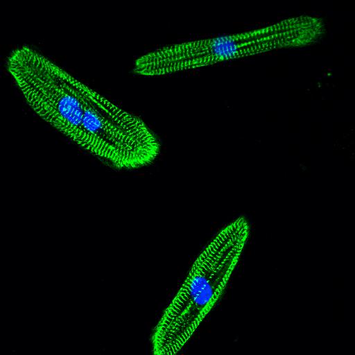 ACTN2 Polyclonal antibody