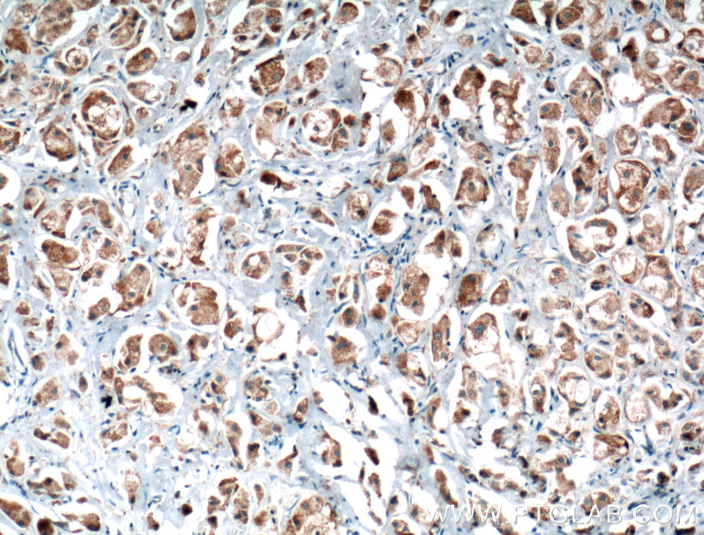 PLCD1 Polyclonal antibody