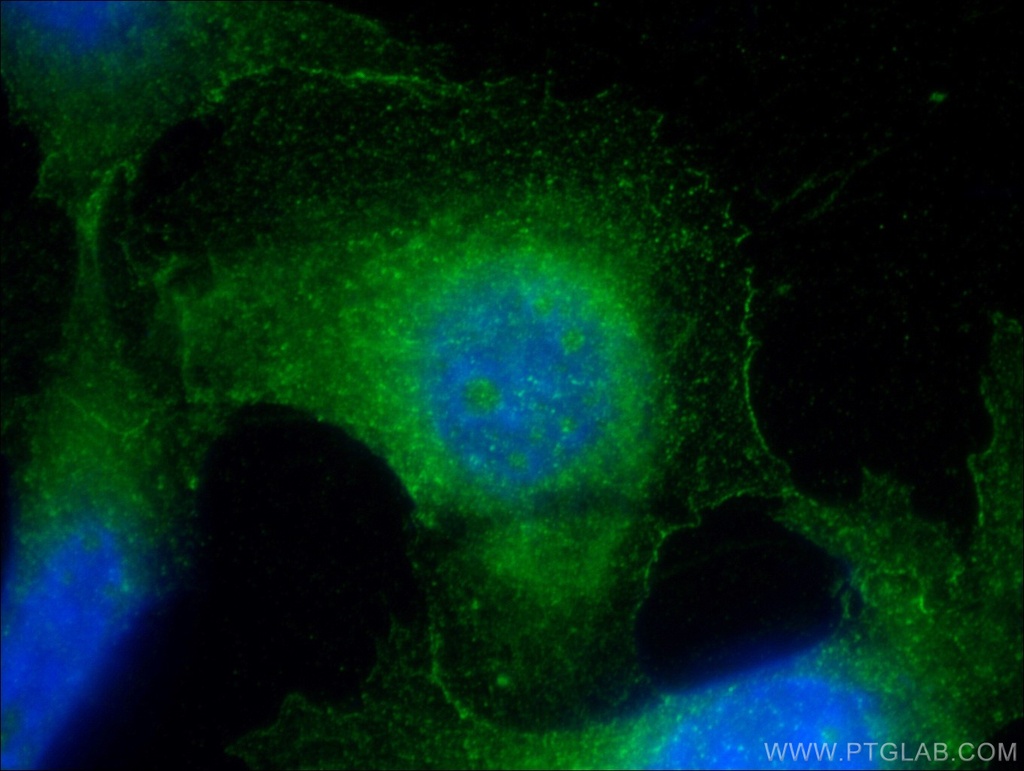 MPI Polyclonal antibody