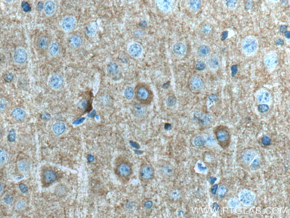 Kv1.2 Polyclonal antibody