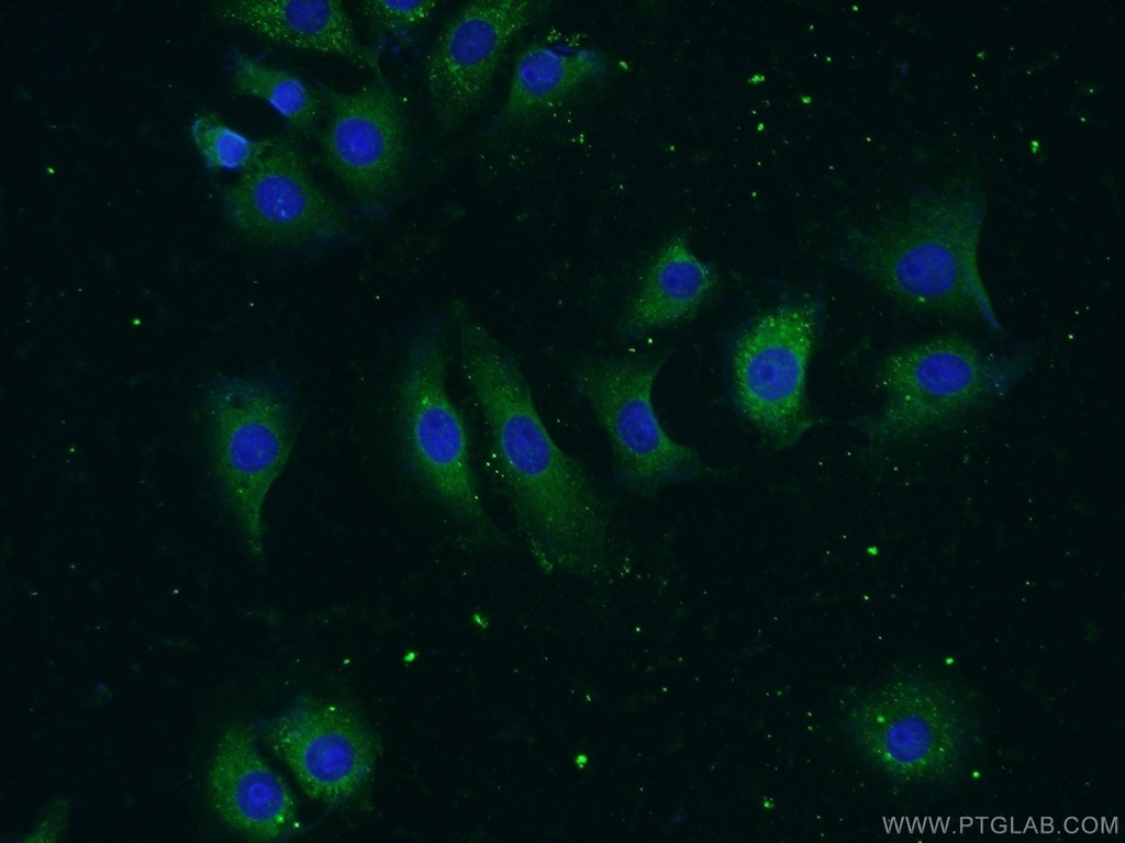 MMP19 Polyclonal antibody