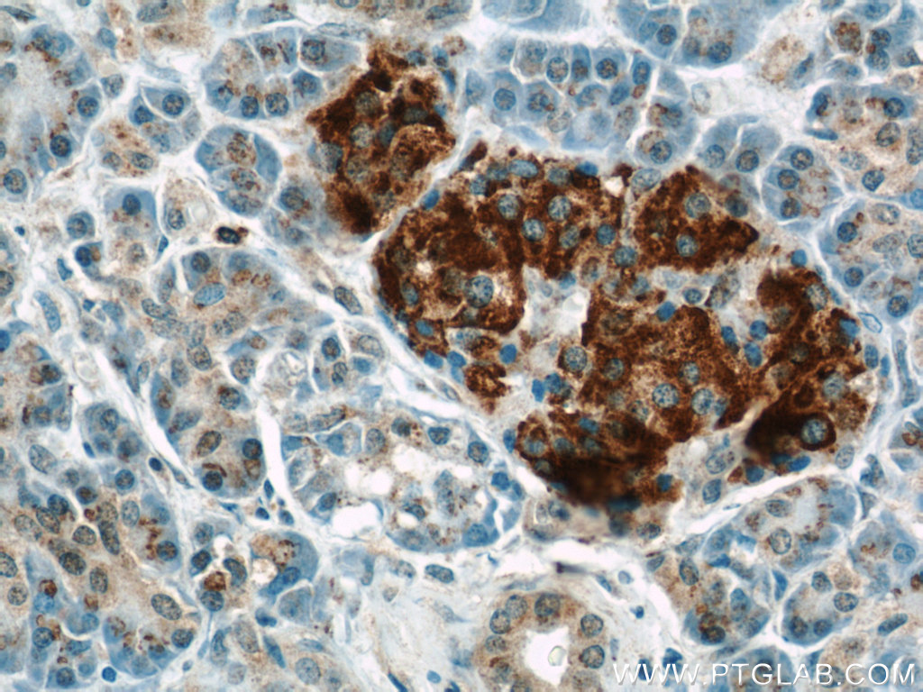 FAM3C Polyclonal antibody