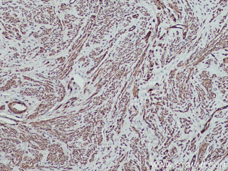 MYL5 Polyclonal antibody