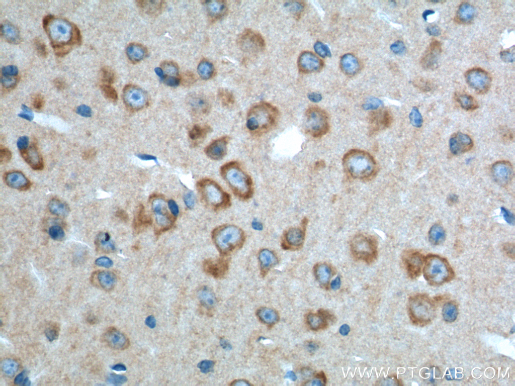 ADRA2A Polyclonal antibody