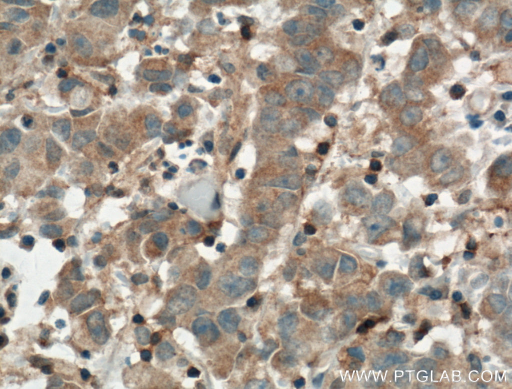 ARNTL Polyclonal antibody