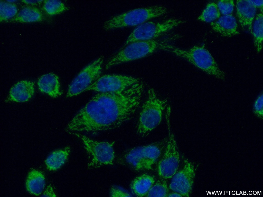 GFM1 Polyclonal antibody