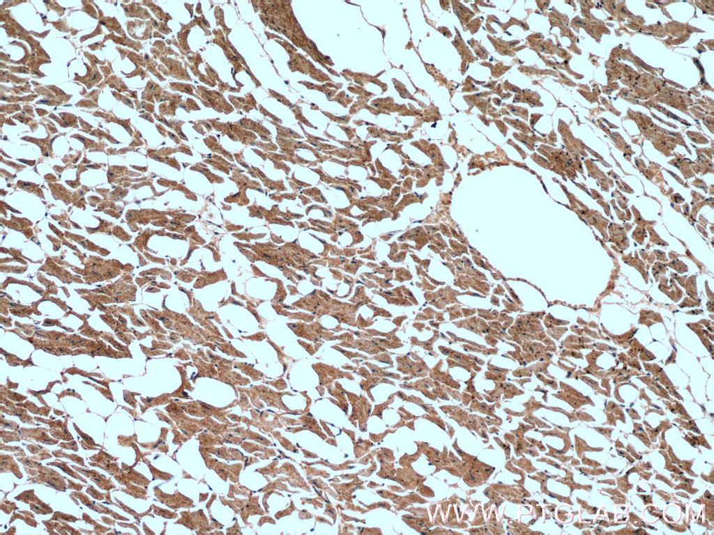 CNOT1 Polyclonal antibody