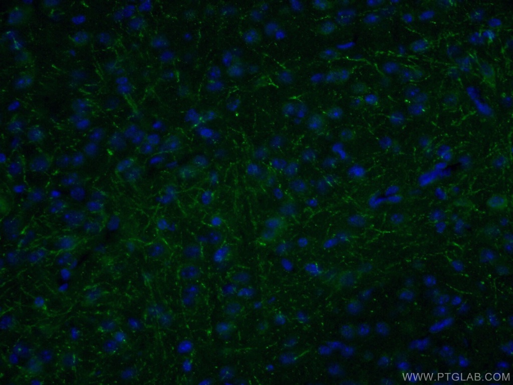 LRRTM1 Polyclonal antibody