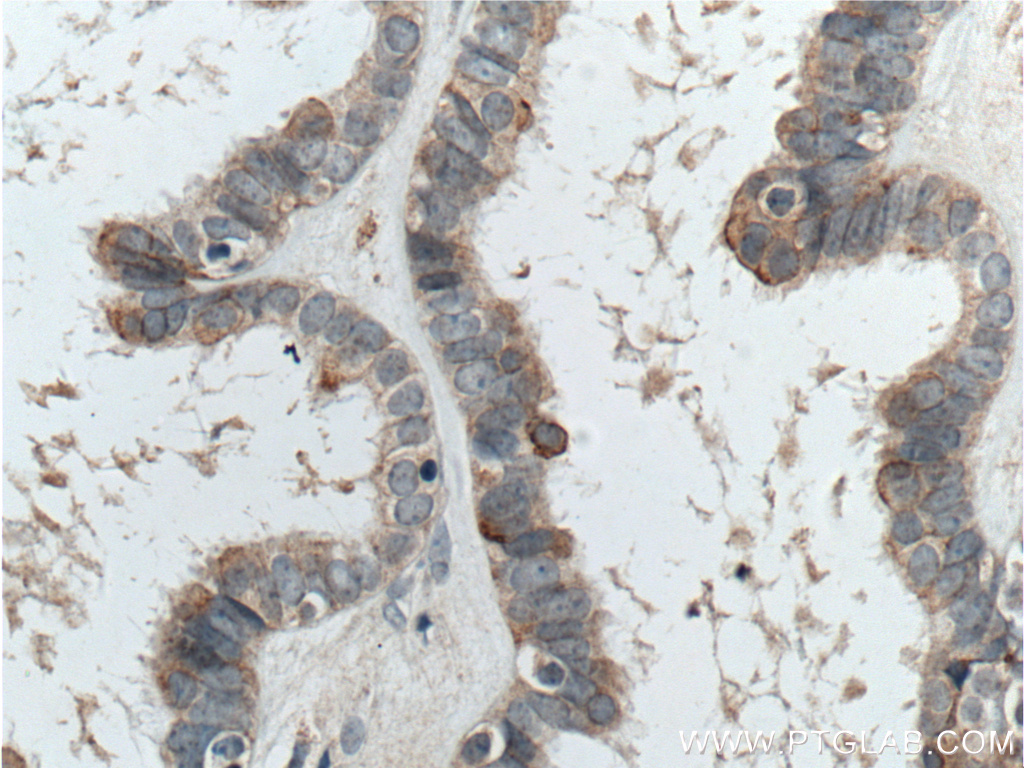 CTSO Polyclonal antibody