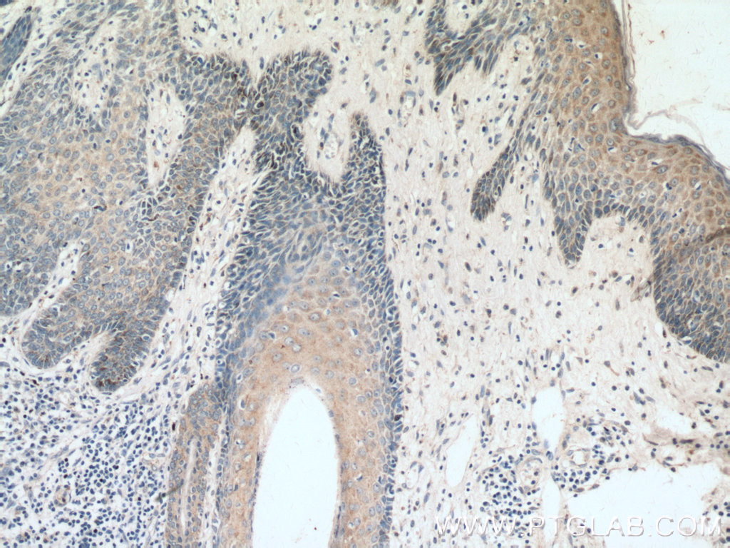 KRT36 Polyclonal antibody
