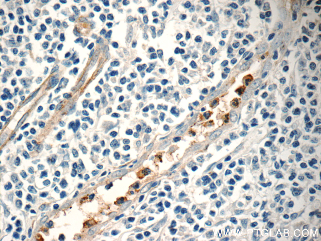 NFAM1 Polyclonal antibody